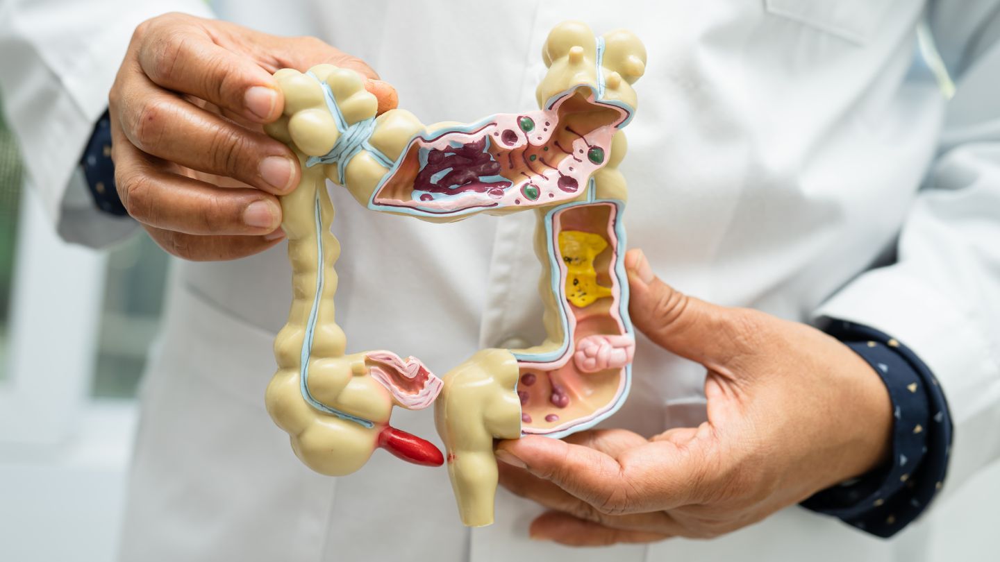 The Role of Stress in Digestive Health